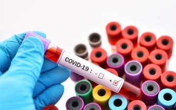 5 people out of 88 tested had confirmed coronavirus
